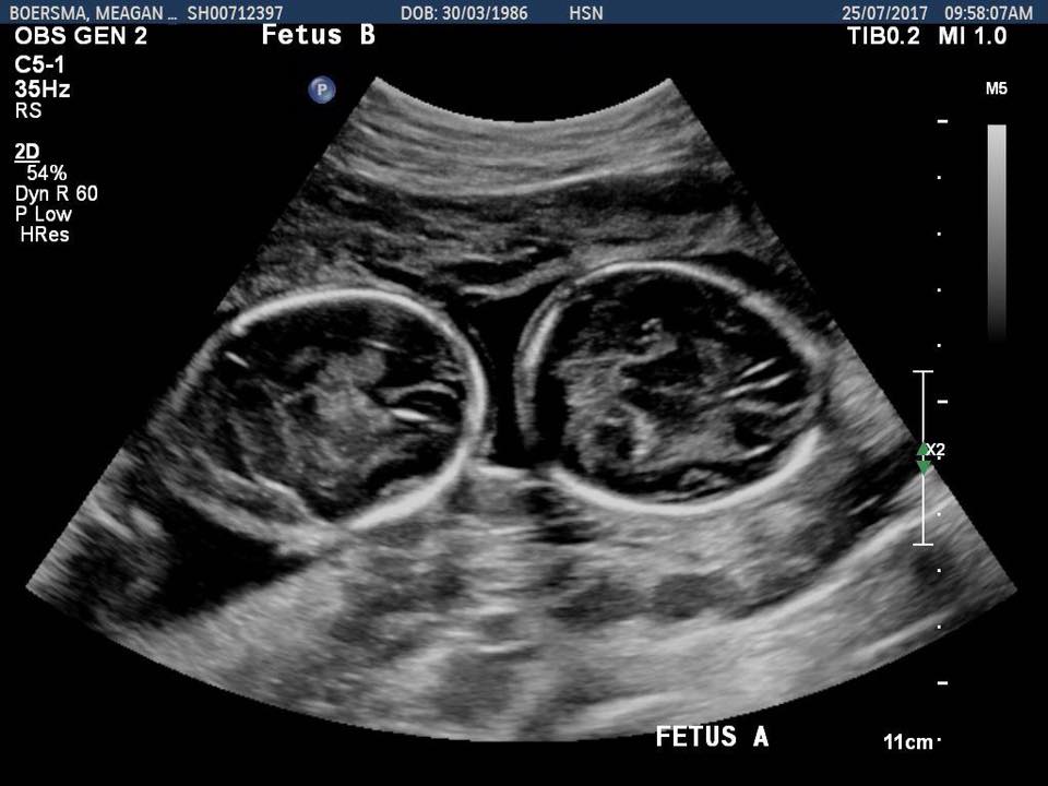 20431381_10155624251039586_941360503889592406_n